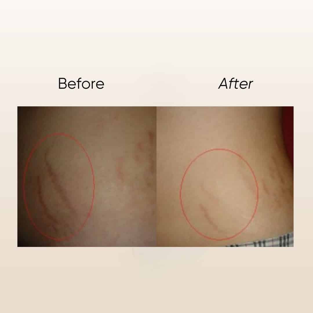 Garden Of Eden Jojo E Stretch Mark Cream 150 Ml