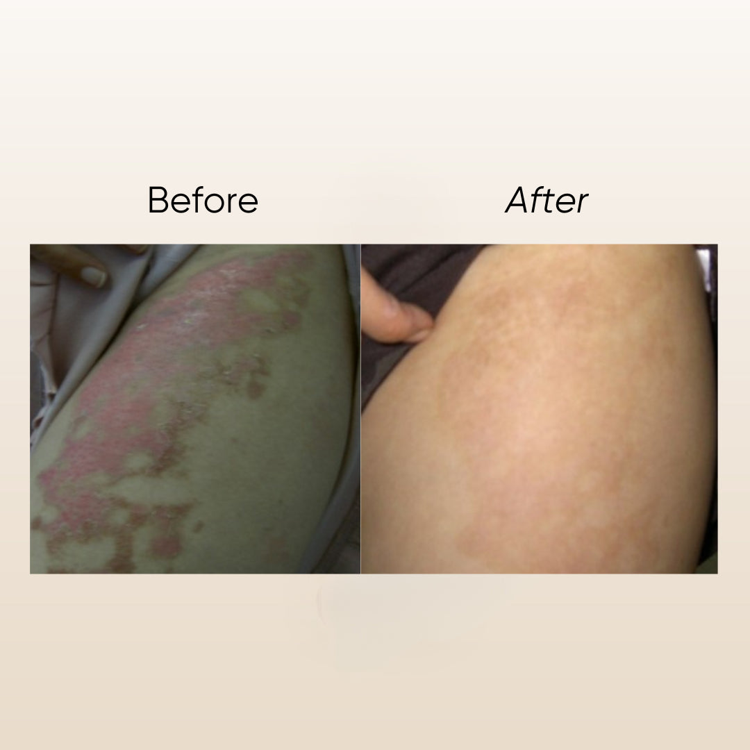 Garden of Eden Nature E Scar Serum