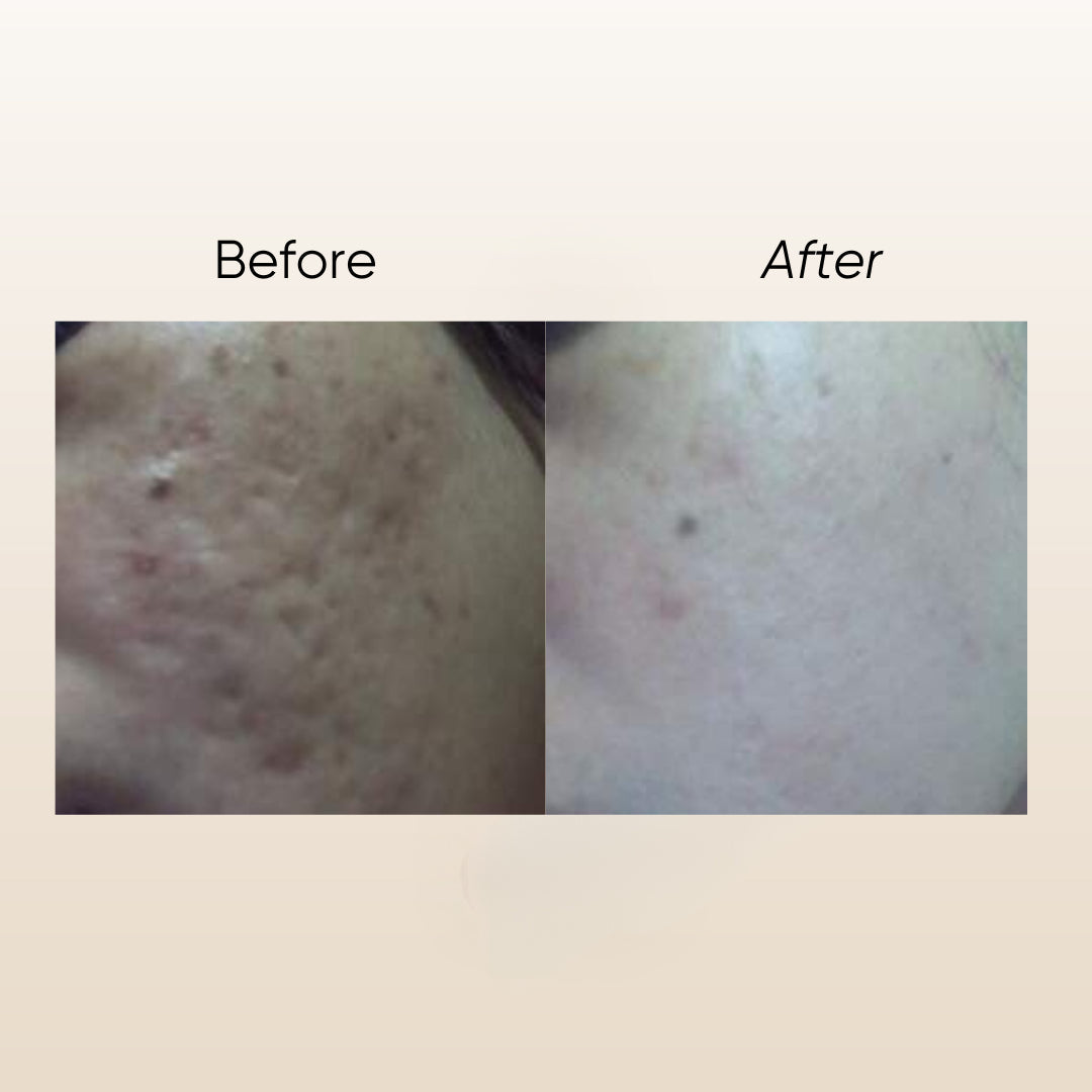 Garden of Eden Nature E Scar Serum